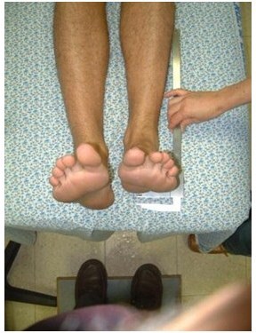 הבדל באורך רגליים - מרכז איימקס